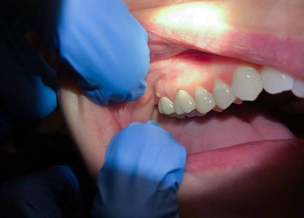 Best Emergency Pediatric Dental Care in Pontiac, MI